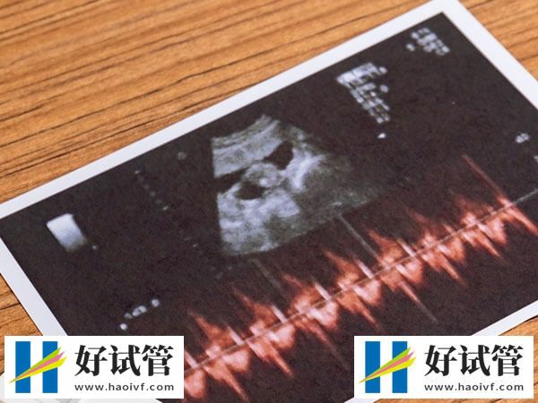 地贫试管婴儿技术讲解,优势、步骤、风险一文通(图2) 地贫试管婴儿技术讲解,优势、步骤、风险一文通(图2)