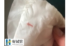 试管移植后着床有什么反应